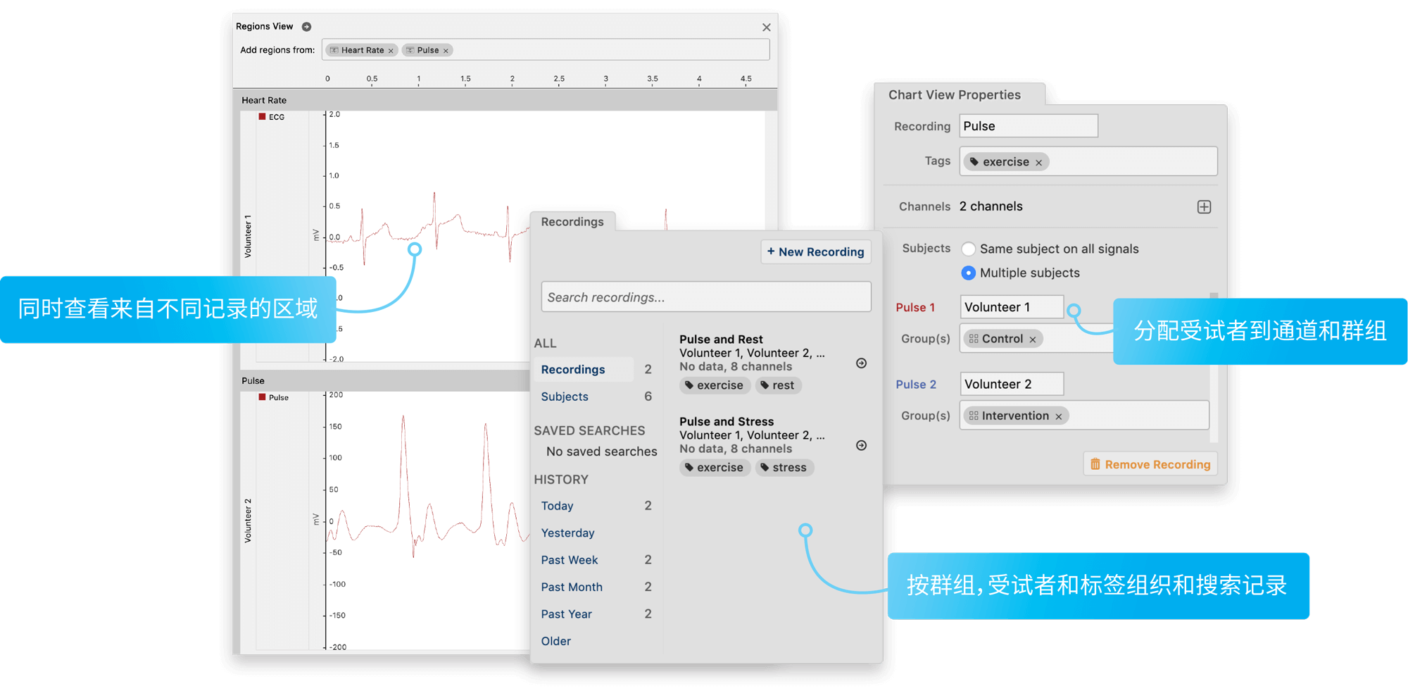 LabChart Lightning - 屏幕背后：软件的内容，原因和位置 | ADInstruments